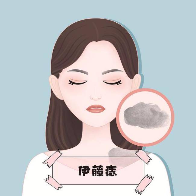 沈阳肤康为您解析：伊藤痣的科学应对与治愈之道！(图2)