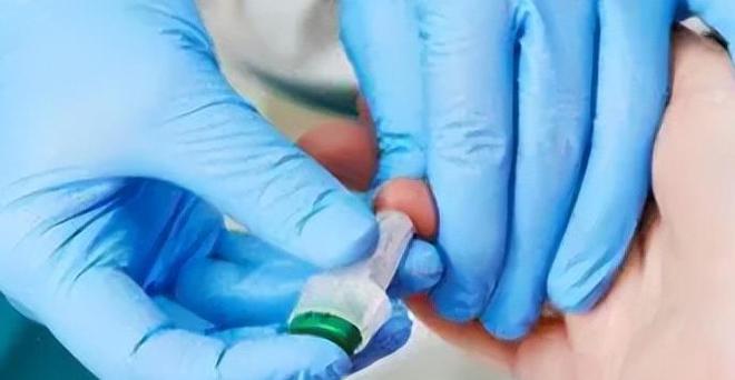 63岁阿姨坚持过午不食半年后去医院体检血压血脂情况变了个样(图4)