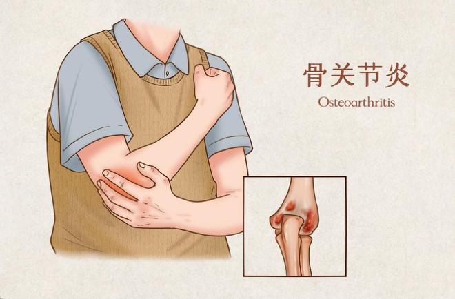 每天半小时姑娘4天后肾破了!很多人有这个爱好千万注意!(图4)